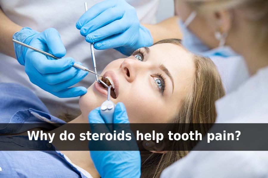are steroids necessary after wisdom teeth removal